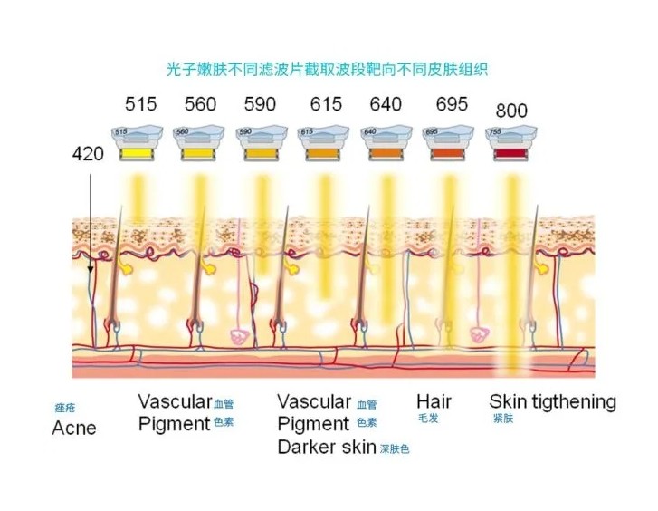 五大光子嫩膚技術(shù)（IPL、DPL、OPT、APT、BBL）及濾光片區(qū)別